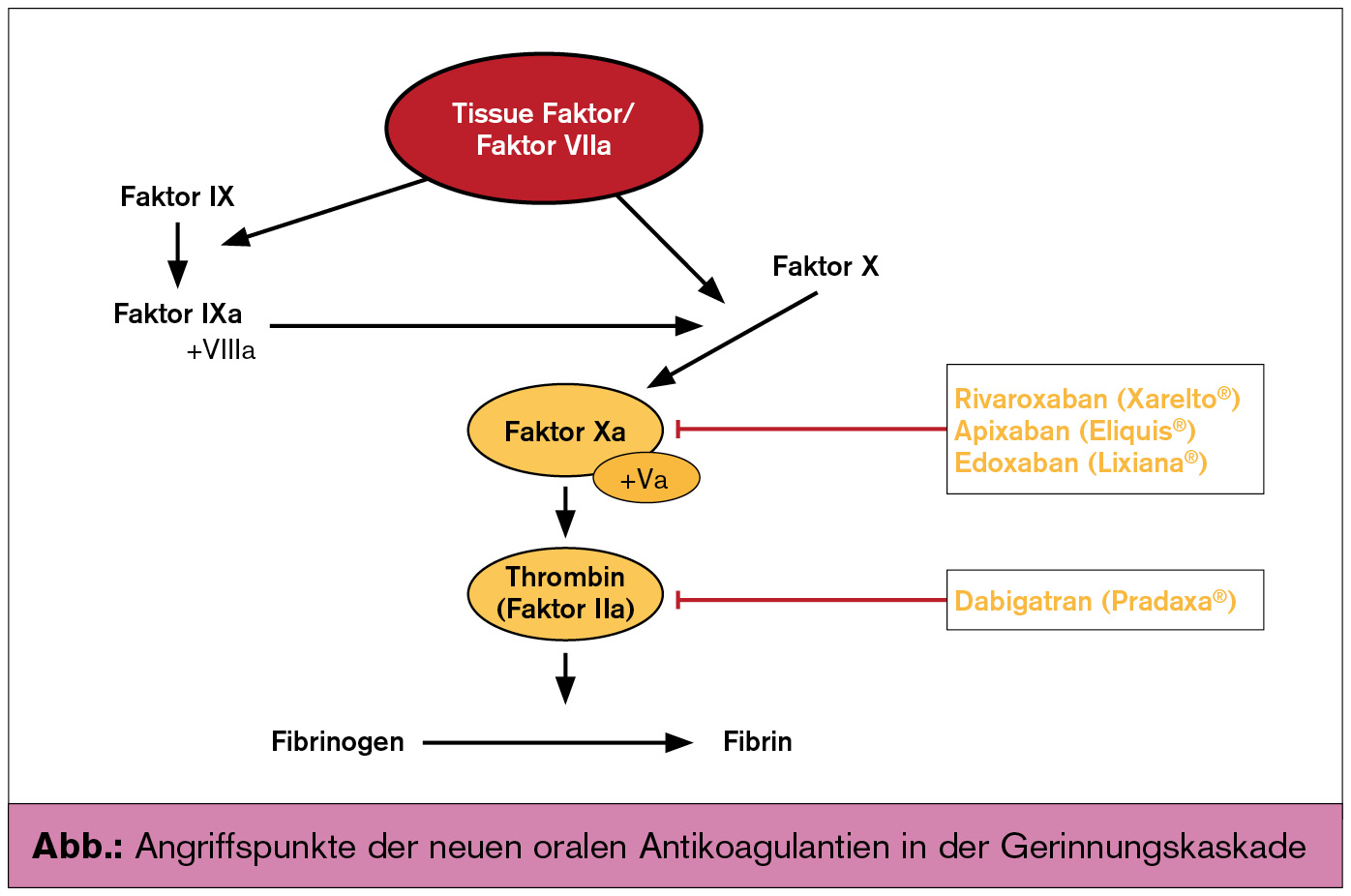 Vorhofflimmern – Indikation Schlaganfallprophylaxe | univ-innere-medizin